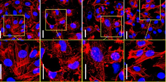 Tumore al cervello, una combinazione di molecole naturali per terapie più efficaci