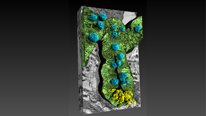 Alzheimer, rivelato il legame intestino-cervello grazie ai raggi X. Una ricerca del Cnr